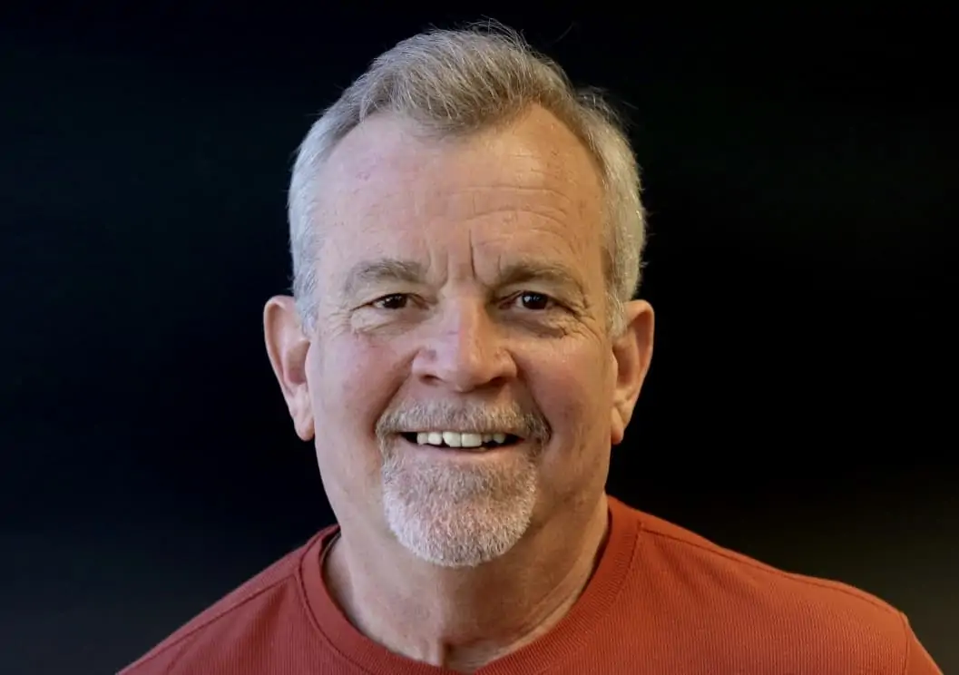 A patient displaying crooked, chipped teeth.