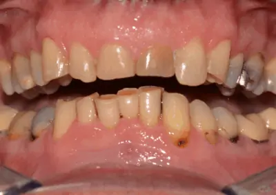 Patient before receiving dental treatment