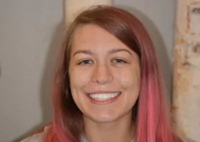 Patient smiling with straight, even, white teeth after receiving treatment at Signature Dentistry of Arvada